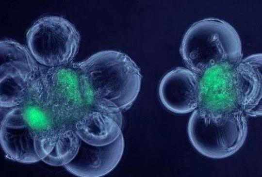 用胚胎干细胞在培养皿中生长的鱼眼  用硬骨鱼的胚胎干细胞培养复杂的视网膜组织