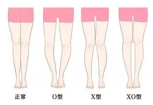 怎样判断自己的腿型 怎样才能让性功能变强